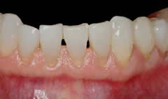 2before