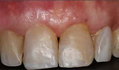 2after