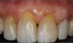 2before