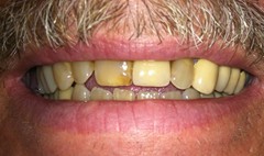 3before