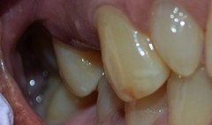 4before