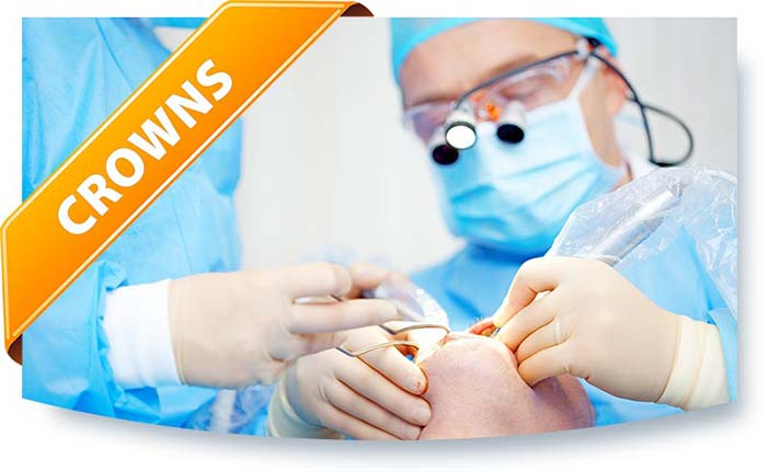 Dental Crowns