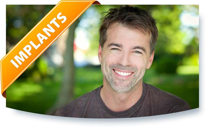 Dental Implants